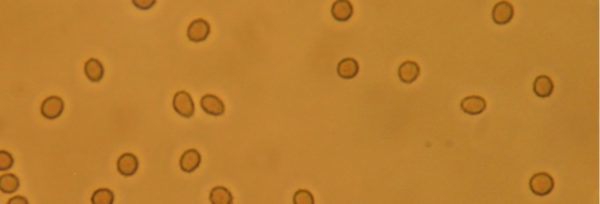 Déficit de Testosterona e implicaciones