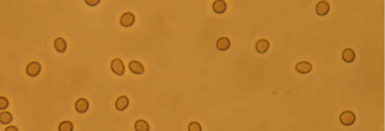 Testosterone deficiency