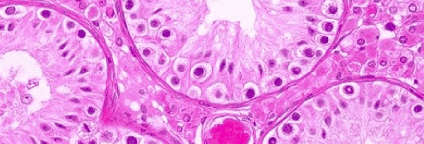 Vasectomía sin bisturí