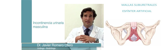 Incontinencia urinaria masculina