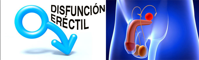 disfunción eréctil