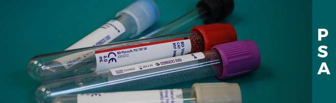 ENUCLEACIÓN DE PRÓSTATA