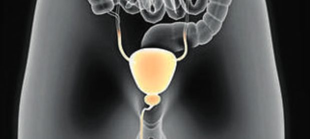 Tratamiento-del-cáncer-de-próstata-mediante-terapia-focal-con-HIFU