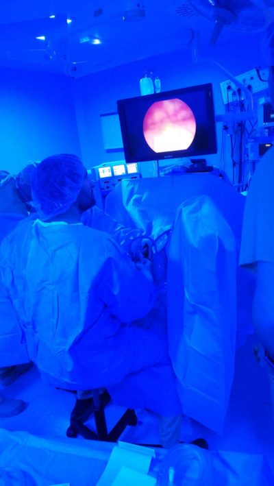 laser Holmium de Boston Scientific