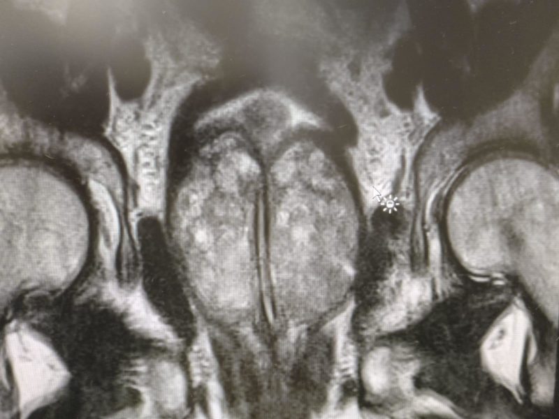 Andrología y Cirugía romero