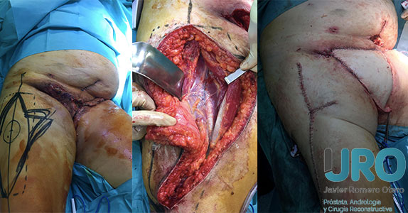 cirugia reconstructiva