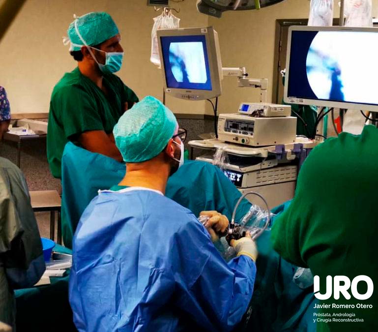 laser de holmium enucleación