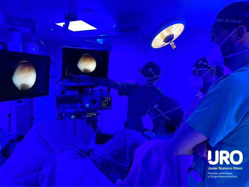 Enucleación con láser holmium