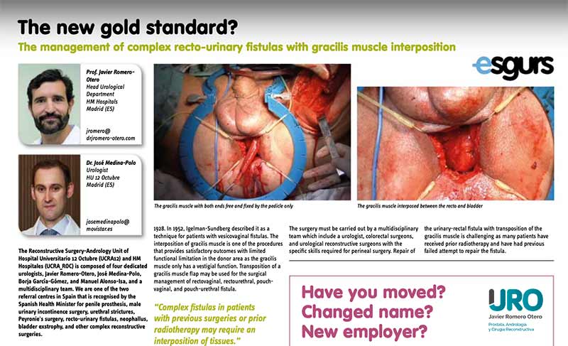 fístula urinaria compleja