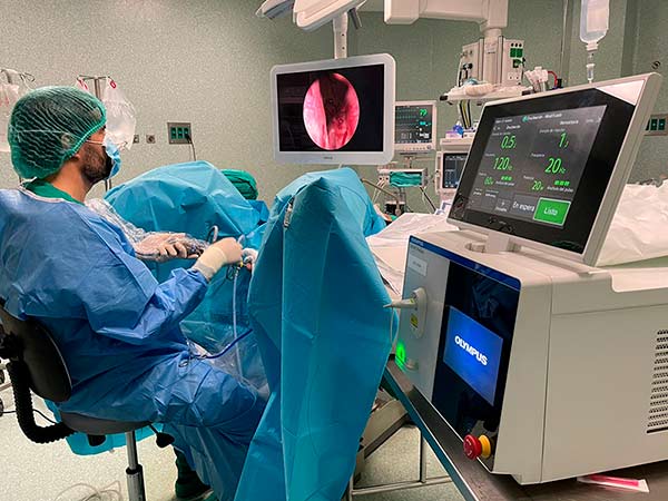 láser soltive olympus