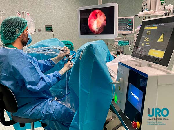 enucleacion de próstata